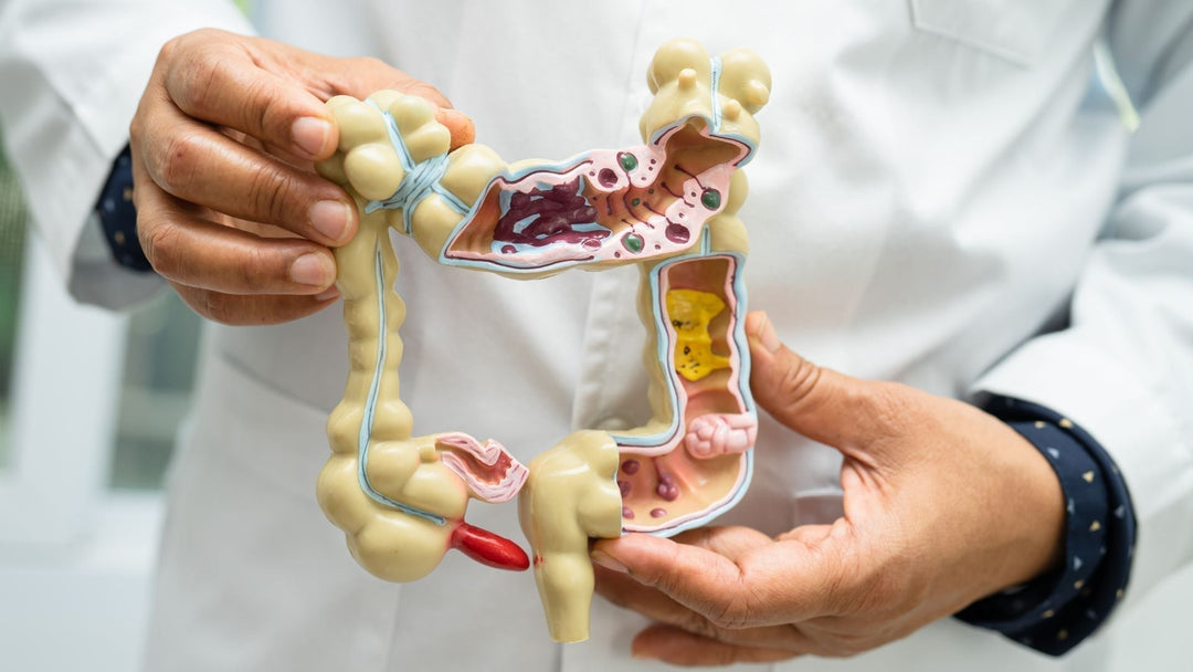 Why Your Gut Struggles in Winter (and What to Do About It)