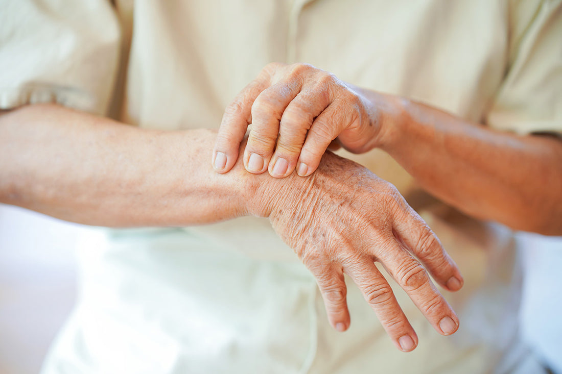 Rheumatoid Arthritis and Cancer: What’s the Connection?